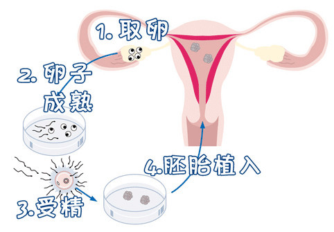 培养箱